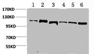 Western blot analysis of 1) Hela, 2) K562, 3) 3T3, 4) Mouse Heart Tissue, 5) Rat Heart Tissue, 6) Rat Kidney Tissue using Stat2 Polyclonal Antibody.