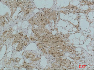 Immunohistochemical analysis of paraffin-embedded Human KidneyTissue using IκB-α Polyclonal Antibody.