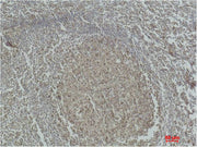 Immunohistochemical analysis of paraffin-embedded Human Tonsil Tissue using Caspase-3 Polyclonal Antibody.