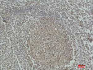 Immunohistochemical analysis of paraffin-embedded Human Tonsil Tissue using Caspase-3 Polyclonal Antibody.