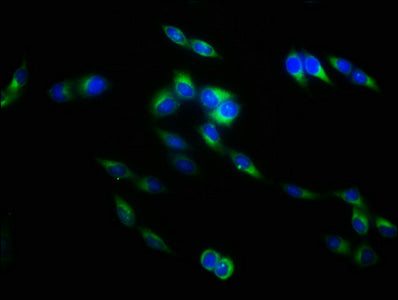 Immunofluorescence staining of Hela cells with CSB-PA08047A0Rb at 1:133, counter-stained with DAPI. The cells were fixed in 4% formaldehyde, permeabilized using 0.2% Triton X-100 and blocked in 10% normal Goat Serum. The cells were then incubated...