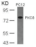 Western blot analysis of extracts from PC12 cells using PKCd(Ab-645) Antibody.