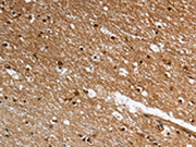 The image on the left is immunohistochemistry of paraffin-embedded Human brain tissue using CSB-PA080695(LGR5 Antibody) at dilution 1/25, on the right is treated with fusion protein. (Original magnification: ×200)