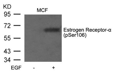 Western blot analysis of extracts from MCF7 cells untreated or treated with EGF using Estrogen Receptor-a(Phospho-Ser106) Antibody.