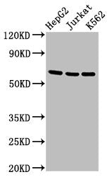 Western Blot Positive WB detected in: HepG2 whole cell lysate, Jurkat whole cell lysate, K562 whole cell lysate All lanes: TNFRSF9 antibody at 2.7µg/ml Secondary Goat polyclonal to rabbit IgG at 1/50000 dilution Predicted band size: 28 kDa Observe...