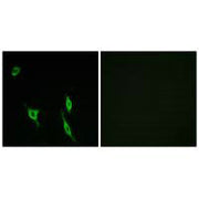 Immunofluorescence analysis of LOVO cells, using DCC antibody.