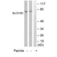 Western blot analysis of extracts from COLO205 and Jurkat cells, using SLCO1B1 antibody.