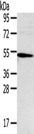 Gel: 8%SDS-PAGE, Lysate: 40 ug, Lane: Hepg2 cells, Primary antibody: CSB-PA081622(TNFRSF4 Antibody) at dilution 1/250, Secondary antibody: Goat anti rabbit IgG at 1/8000 dilution, Exposure time: 5 minutes