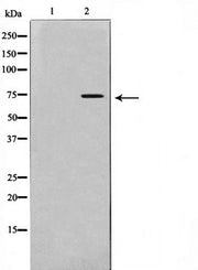 Western blot analysis on HeLa cell lysate using IL-2Rbeta/CD122 antibody,The lane on the left is treated with the antigen-specific peptide.
