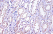 Immunohistochemistry of paraffin-embedded human kidney tissue using CSB-PA08209A0Rb at dilution of 1:100