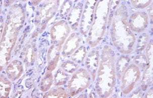 Immunohistochemistry of paraffin-embedded human kidney tissue using CSB-PA08209A0Rb at dilution of 1:100