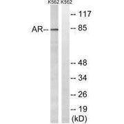 Western blot analysis of extracts from K562 cells, treated with EGF (200ng/ml, 5mins), using Androgen Receptor (Ab-363) antibody.