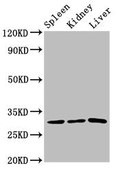 Western Blot Positive WB detected in: Rat spleen tissue, Rat kidney tissue, Rat liver tissue All lanes: CD27 antibody at 3.2µg/ml Secondary Goat polyclonal to rabbit IgG at 1/50000 dilution Predicted band size: 30 kDa Observed band size: 30 kDa