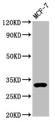 Western Blot Positive WB detected in: MCF-7 whole cell lysate All lanes: DKK2 antibody at 3.9µg/ml Secondary Goat polyclonal to rabbit IgG at 1/50000 dilution Predicted band size: 29 kDa Observed band size: 32 kDa