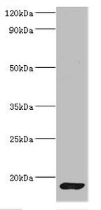 Western blot All lanes: CALM1 antibody at 2µg/ml + Mouse skeletal muscle tissue Secondary Goat polyclonal to rabbit IgG at 1/10000 dilution Predicted band size: 17 kDa Observed band size: 17 kDa
