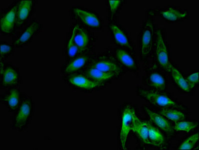 Immunofluorescent analysis of Hela cells using CSB-PA08329A0Rb at dilution of 1:100 and Alexa Fluor 488-congugated AffiniPure Goat Anti-Rabbit IgG(H+L)