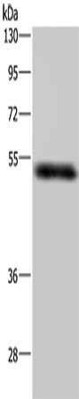 Gel: 8%SDS-PAGE, Lysate: 40 ug, Lane: Human placenta tissue, Primary antibody: CSB-PA083562(STK26 Antibody) at dilution 1/400, Secondary antibody: Goat anti rabbit IgG at 1/8000 dilution, Exposure time: 5 minutes