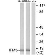 Western blot analysis of extracts from HepG2 cells and HeLa cells, using IFM3 antibody.