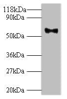 Western blot All lanes: Major capsid protein L1 antibody at 2ug/ml + 293T whole cell lysate Secondary Goat polyclonal to rabbit IgG at 1/10000 dilution Predicted band size: 62 kDa Observed band size: 62 kDa