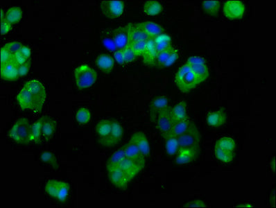 Immunofluorescence staining of MCF-7 cells with CSB-PA08395A0Rb at 1:400, counter-stained with DAPI. The cells were fixed in 4% formaldehyde, permeabilized using 0.2% Triton X-100 and blocked in 10% normal Goat Serum. The cells were then incubated...