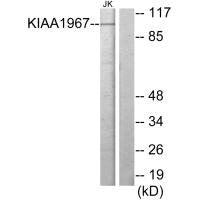 Western blot analysis of extracts from Jurkat cells, using KIAA1967 antibody.