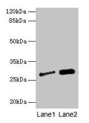 Western blot All lanes: IGFBP1 antibody at 3µg/ml Lane 1: A549 whole cell lysate Lane 2: PC-3 whole cell lysate Secondary Goat polyclonal to rabbit IgG at 1/10000 dilution Predicted band size: 28 kDa Observed band size: 28 kDa