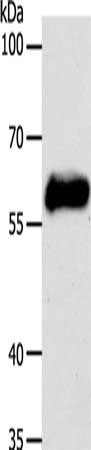 Gel: 8%SDS-PAGE, Lysate: 40 ug, Lane: MCF7 cells, Primary antibody: CSB-PA084371(KRT10 Antibody) at dilution 1/750, Secondary antibody: Goat anti rabbit IgG at 1/8000 dilution, Exposure time: 30 seconds