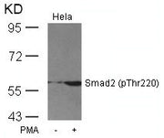 Western blot analysis of extracts from Hela cells untreated or treated with PMA using Smad2(Phospho-Thr220) Antibody.