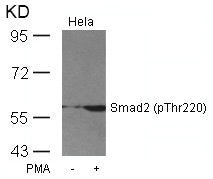 Western blot analysis of extracts from Hela cells untreated or treated with PMA using Smad2(Phospho-Thr220) Antibody.