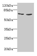 Western blot All lanes: TNFRSF11A antibody at 2µg/ml Lane 1: EC109 whole cell lysate Lane 2: 293T whole cell lysate Secondary Goat polyclonal to rabbit IgG at 1/15000 dilution Predicted band size: 67, 33, 37, 29, 57, 65 kDa Observed band size: 67 kDa