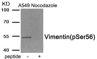 Western blot analysis of extracts from A549 cells treated with Nocodazole using Phospho-Vimentin (Ser56) antibody.The lane on the right is treated with the antigen-specific peptide.