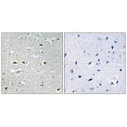 Immunohistochemistry analysis of paraffin-embedded human brain tissue using URB1 antibody.