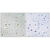 Immunohistochemistry analysis of paraffin-embedded human brain tissue using URB1 antibody.
