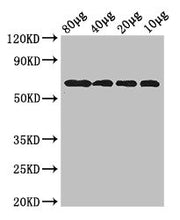 Western Blot Positive WB detected in: Rosseta bacteria lysate at 80ug, 40ug, 20ug, 10ug All lanes: yedQ antibody at 2.5ug/ml Secondary Goat polyclonal to rabbit IgG at 1/50000 dilution predicted band size: 65 kDa observed band size: 65 kDa
