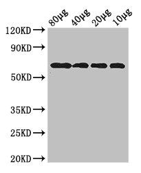 Western Blot Positive WB detected in: Rosseta bacteria lysate at 80ug, 40ug, 20ug, 10ug All lanes: yedQ antibody at 2.5ug/ml Secondary Goat polyclonal to rabbit IgG at 1/50000 dilution predicted band size: 65 kDa observed band size: 65 kDa