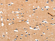 The image on the left is immunohistochemistry of paraffin-embedded Human brain tissue using CSB-PA085715(CHRNA3 Antibody) at dilution 1/30, on the right is treated with synthetic peptide. (Original magnification: ×200)