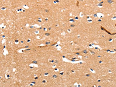 The image on the left is immunohistochemistry of paraffin-embedded Human brain tissue using CSB-PA085715(CHRNA3 Antibody) at dilution 1/30, on the right is treated with synthetic peptide. (Original magnification: ×200)