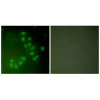 Immunofluorescence analysis of A549 cells, using p63 antibody.