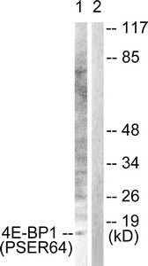 Western blot analysis of extracts from Jurkat cells, treated with Insulin (0.01U/ml, 15mins), using 4E-BP1 (Phospho-Ser64) antibody . The lane on the right is treated with the synthesized peptide.