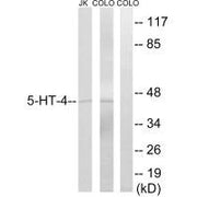 Western blot analysis of extracts from JK and colo cells, using 5-HT-4 antibody.