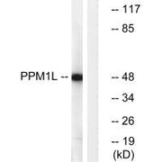 Western blot analysis of extracts from Jurkat cells, using PPM1L antibody.