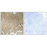 Immunohistochemistry analysis of paraffin-embedded human skeletal muscle tissue using RAB34 antibody.