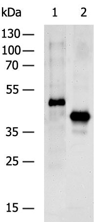 Gel: 8%SDS-PAGE Lysate:40ug 293T cells transfected with DYKDDDDK-tagged protein vectorPrimary antibody: 1/500 dilution Secondary antibody dilution: 1/8000 Exposure time: 30 seconds