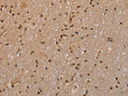 The image is immunohistochemistry of paraffin-embedded Human brain tissue using CSB-PA087396(GADD45A Antibody) at dilution 1/30. (Original magnification: ×200)