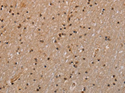 The image is immunohistochemistry of paraffin-embedded Human brain tissue using CSB-PA087396(GADD45A Antibody) at dilution 1/30. (Original magnification: ×200)