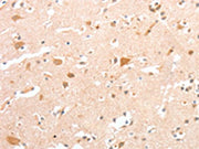 The image on the left is immunohistochemistry of paraffin-embedded Human brain tissue using CSB-PA087998(CIDEC Antibody) at dilution 1/30, on the right is treated with fusion protein. (Original magnification: ×200)