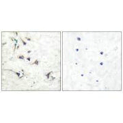 Immunohistochemical analysis of paraffin-embedded human brain tissue using Ezrin antibody.