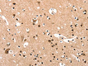 The image on the left is immunohistochemistry of paraffin-embedded Human brain tissue using CSB-PA088085(ELOVL6 Antibody) at dilution 1/25, on the right is treated with synthetic peptide. (Original magnification: ×200)