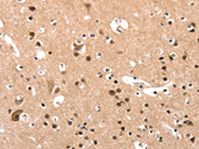 The image on the left is immunohistochemistry of paraffin-embedded Human brain tissue using CSB-PA088085(ELOVL6 Antibody) at dilution 1/25, on the right is treated with synthetic peptide. (Original magnification: ×200)