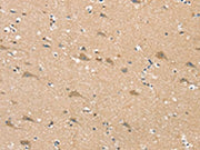 The image on the left is immunohistochemistry of paraffin-embedded Human brain tissue using CSB-PA088132(SGPL1 Antibody) at dilution 1/25, on the right is treated with synthetic peptide. (Original magnification: ×200)